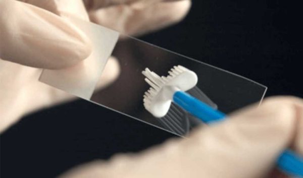 smear-testi-nedir-smear-testi-fiyati-2020-1-600x353